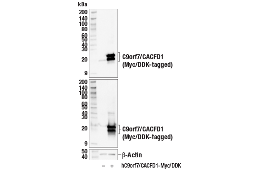 Western Blotting Image 2: C9orf7/CACFD1 (E6E3J) Rabbit Monoclonal Antibody