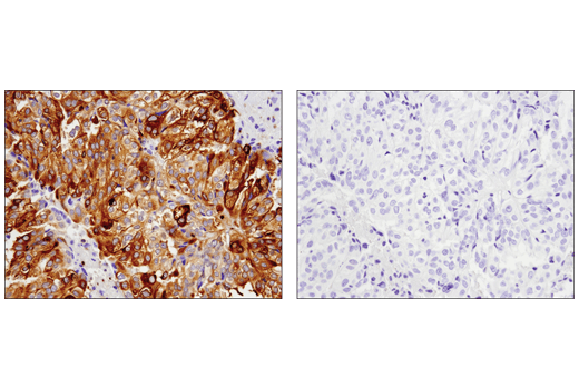 Immunohistochemistry Image 3: Phospho-Glycogen Synthase (Ser641) (D4H1B) Rabbit Monoclonal Antibody