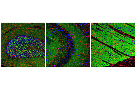 Immunofluorescence Image 1: SHANK3 (D5K6R) Rabbit Monoclonal Antibody (BSA and Azide Free)