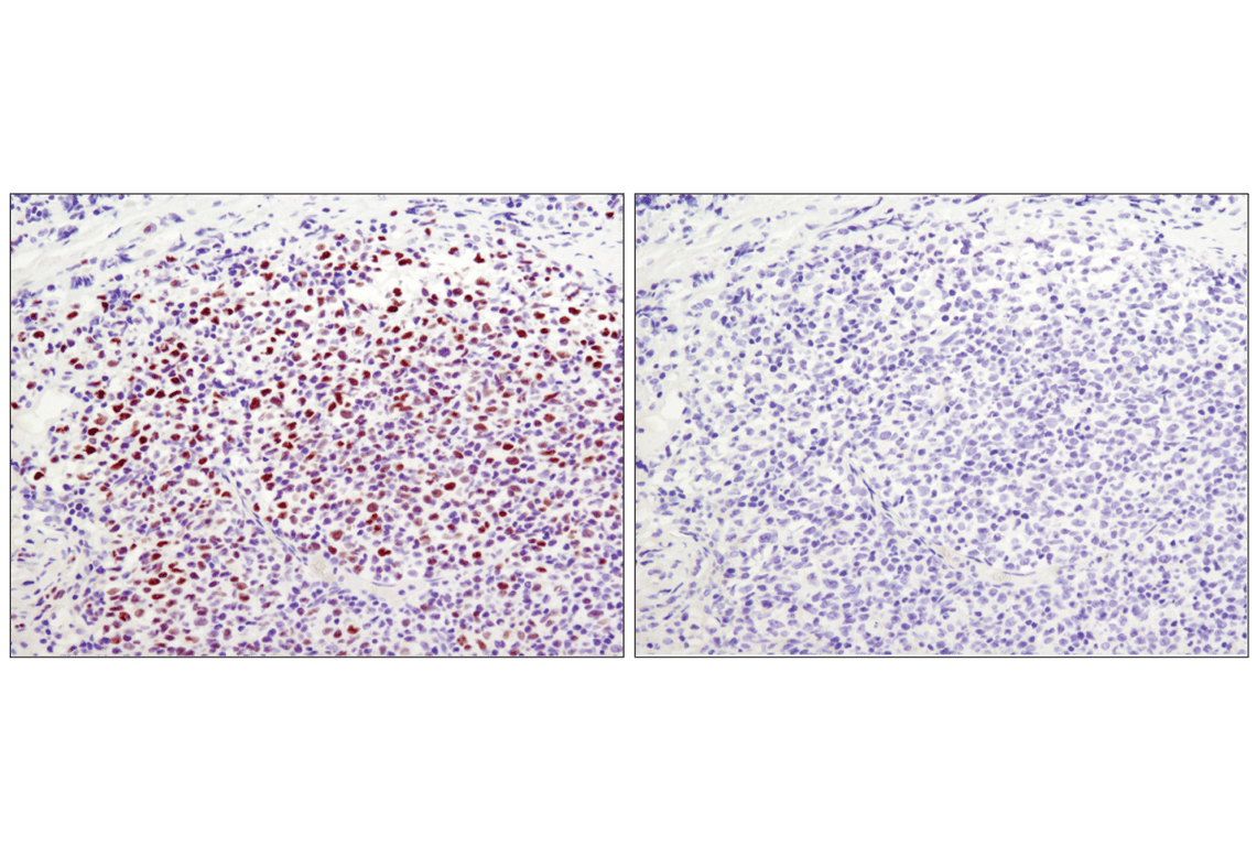 Tri-Methyl-Histone H3 (Lys27) (C36B11) Rabbit mAb (BSA and