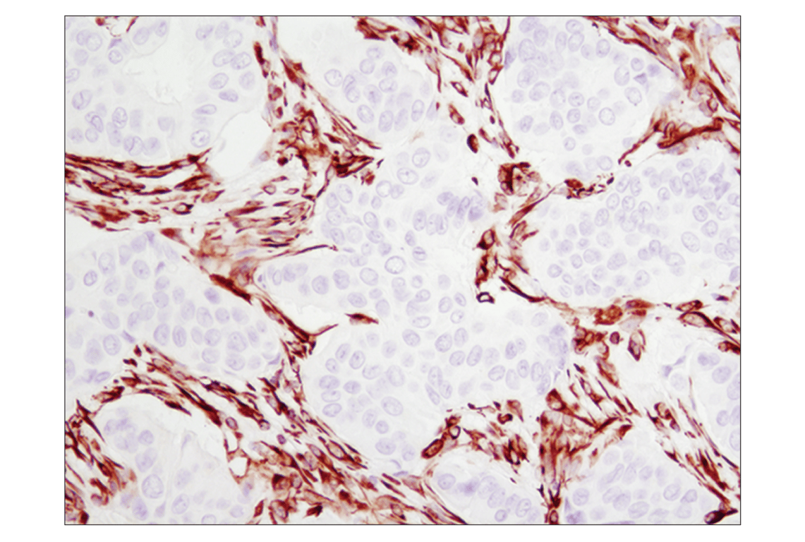 Immunohistochemistry Image 1: Vimentin (D21H3) Rabbit Monoclonal Antibody (BSA and Azide Free)