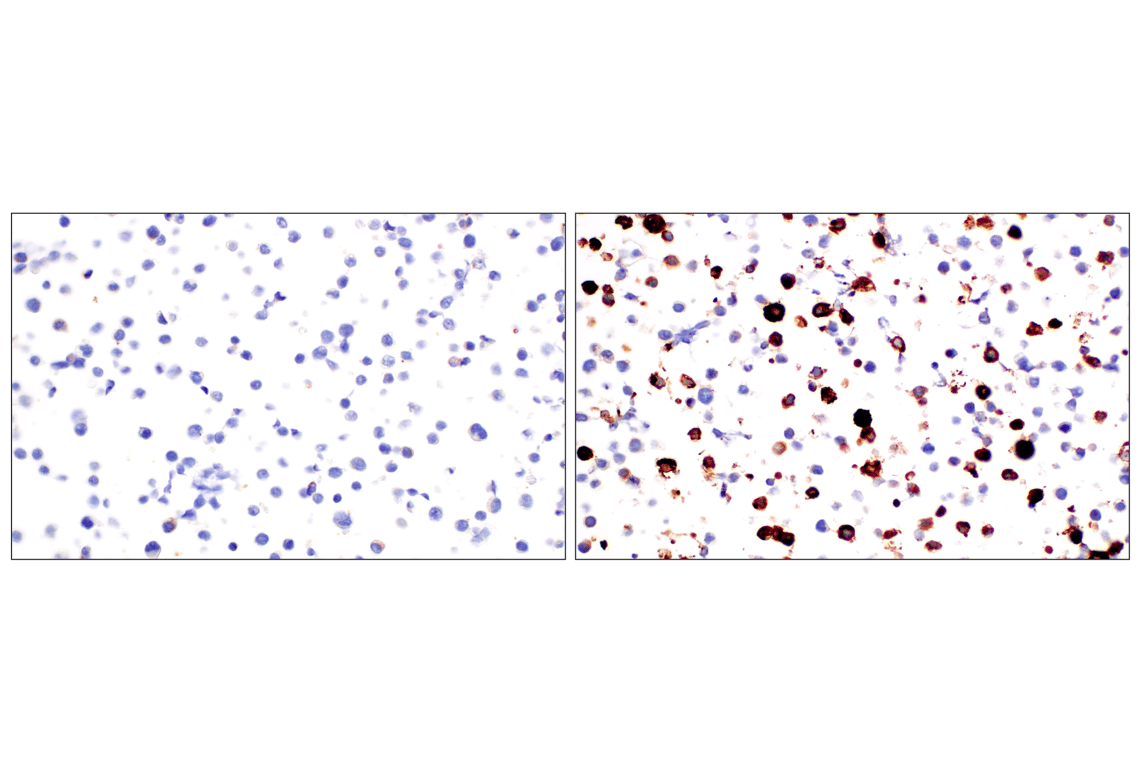 Immunohistochemistry Image 6: Osteocalcin (E8B9X) Rabbit Monoclonal Antibody