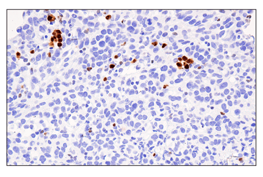 Immunohistochemistry Image 1: IRF-4 (E8H3S) Rabbit Monoclonal Antibody (BSA and Azide Free)