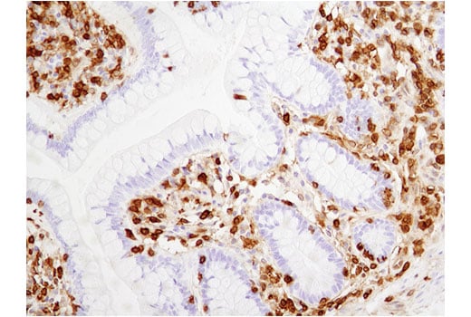 Immunohistochemistry Image 1: Annexin A1 (D5V2T) XP<sup>®</sup> Rabbit mAb (BSA and Azide Free)