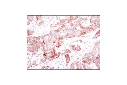 Immunohistochemistry Image 2: Stathmin Antibody
