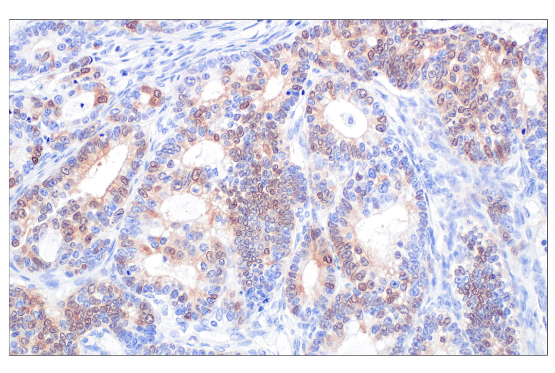 Immunohistochemistry Image 5: p16 INK4A (F9T1L) Rabbit Monoclonal Antibody