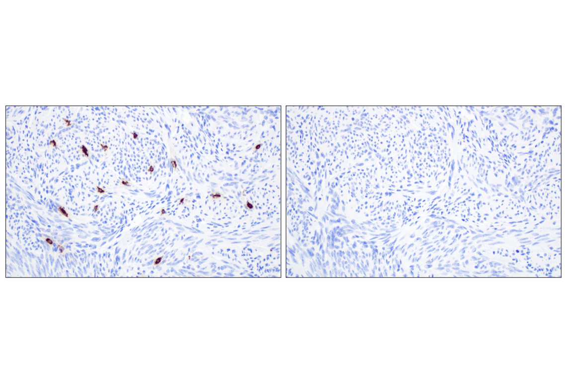 Immunohistochemistry Image 11: Mast Cell Chymase/CMA1 (F6S4Q) Rabbit Monoclonal Antibody