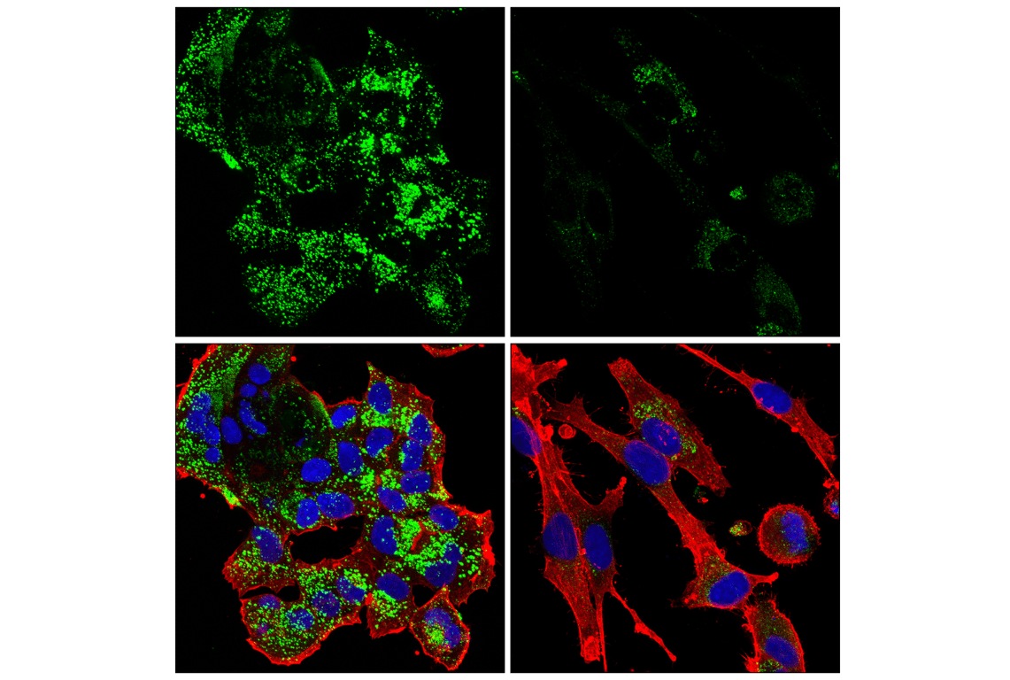 undefined Image 31: Genetics of Parkinson's Disease: Lysosomal Dysfunction Antibody Sampler Kit