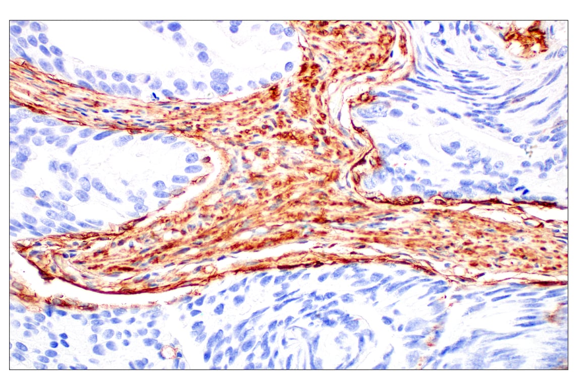 Immunohistochemistry Image 4: Filamin A (E8P8M) Rabbit Monoclonal Antibody