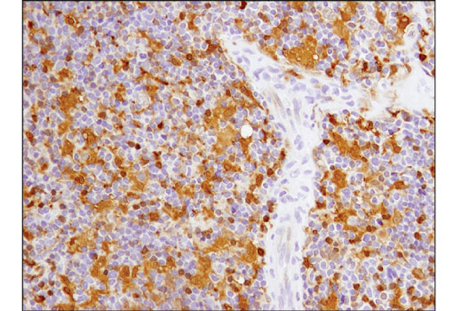 Immunohistochemistry Image 3: Galectin-9 (D9R4A) Rabbit Monoclonal Antibody