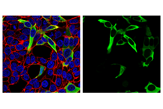 Immunofluorescence Image 2: SARS-CoV-1/2 Nucleocapsid Protein (1C7C7) Mouse Monoclonal Antibody