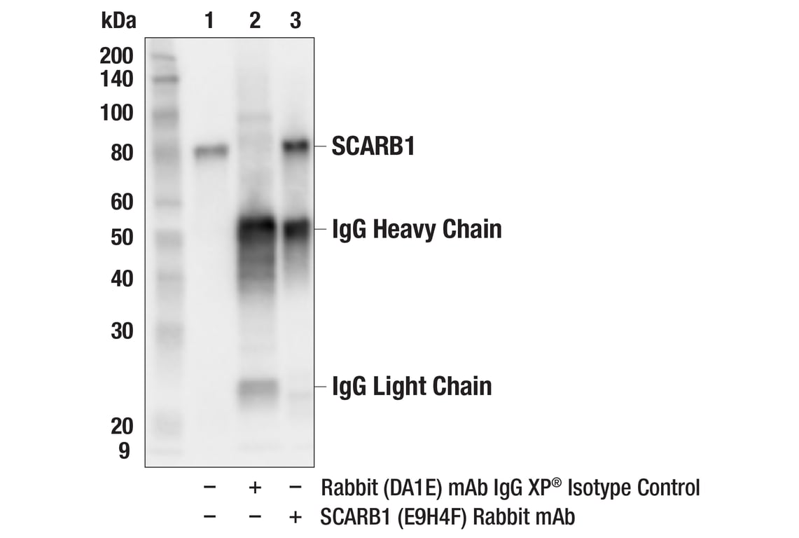 Immunoprecipitation Image 1: SCARB1 (E9H4F) Rabbit Monoclonal Antibody