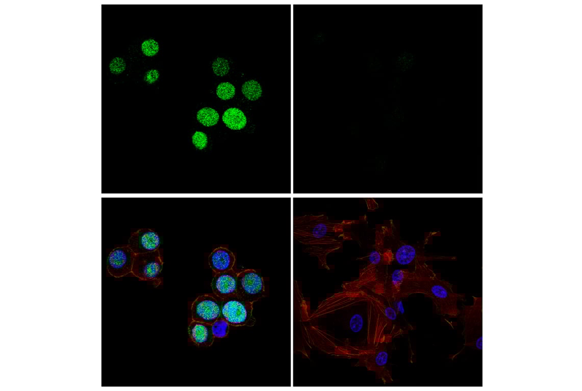 Immunofluorescence Image 1: ASCL1 (E6Y1B) Rabbit Monoclonal Antibody