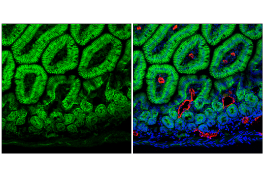 Immunofluorescence Image 3: CMTM6 (E6A8T) Rabbit Monoclonal Antibody