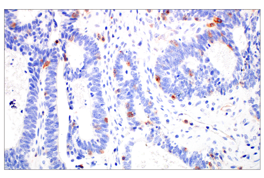 Immunohistochemistry Image 8: CD70 (E3Q1A) Rabbit Monoclonal Antibody (BSA and Azide Free)