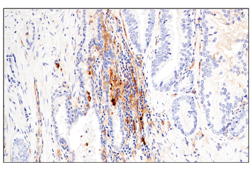 Immunohistochemistry Image 3: CD54/ICAM-1 (E3Q9N) Rabbit Monoclonal Antibody (BSA and Azide Free)