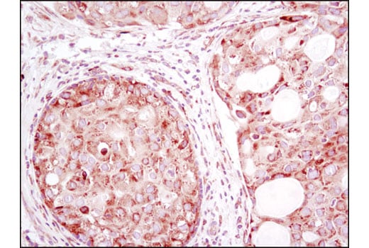 undefined Image 3: PhosphoPlus<sup>®</sup> YB1 (Ser102) Antibody Duet