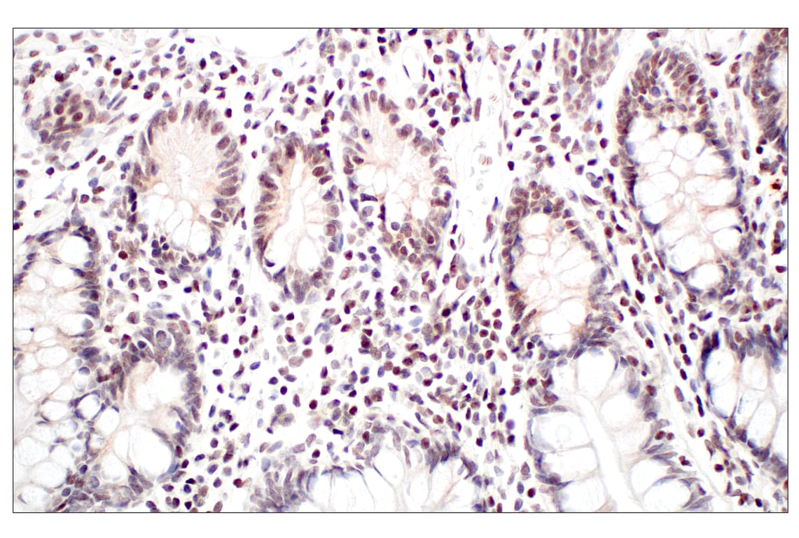 Immunohistochemistry Image 6: Menin (E5P1R) Rabbit Monoclonal Antibody