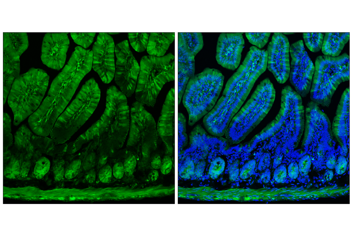 Immunofluorescence Image 1: YAP (D8H1X) Rabbit Monoclonal Antibody
