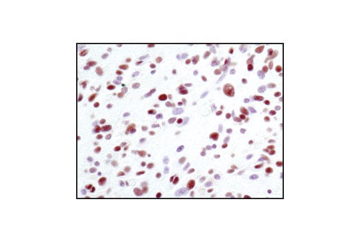 Immunohistochemistry Image 1: Ku80 (C48E7) Rabbit Monoclonal Antibody