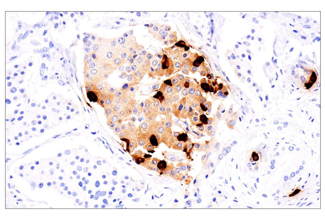 Immunohistochemistry Image 1: Somatostatin (F8W1R) Rabbit Monoclonal Antibody