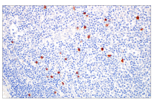 Immunohistochemistry Image 7: TRDC/TCR delta (E2E9T) Rabbit Monoclonal Antibody (BSA and Azide Free)