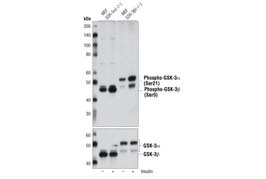 Western Blotting Image 2: Phospho-GSK-3 alpha/beta (Ser21/9) (D17D2) Rabbit Monoclonal Antibody