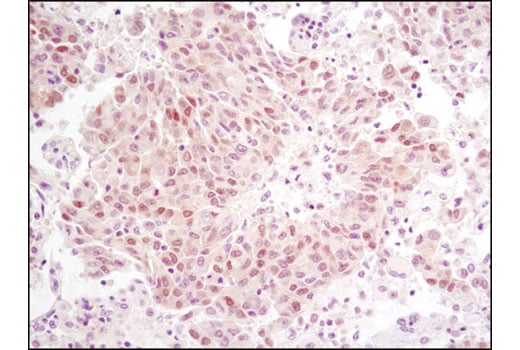 Immunohistochemistry Image 2: RSK2 (D21B2) Rabbit Monoclonal Antibody (BSA and Azide Free)