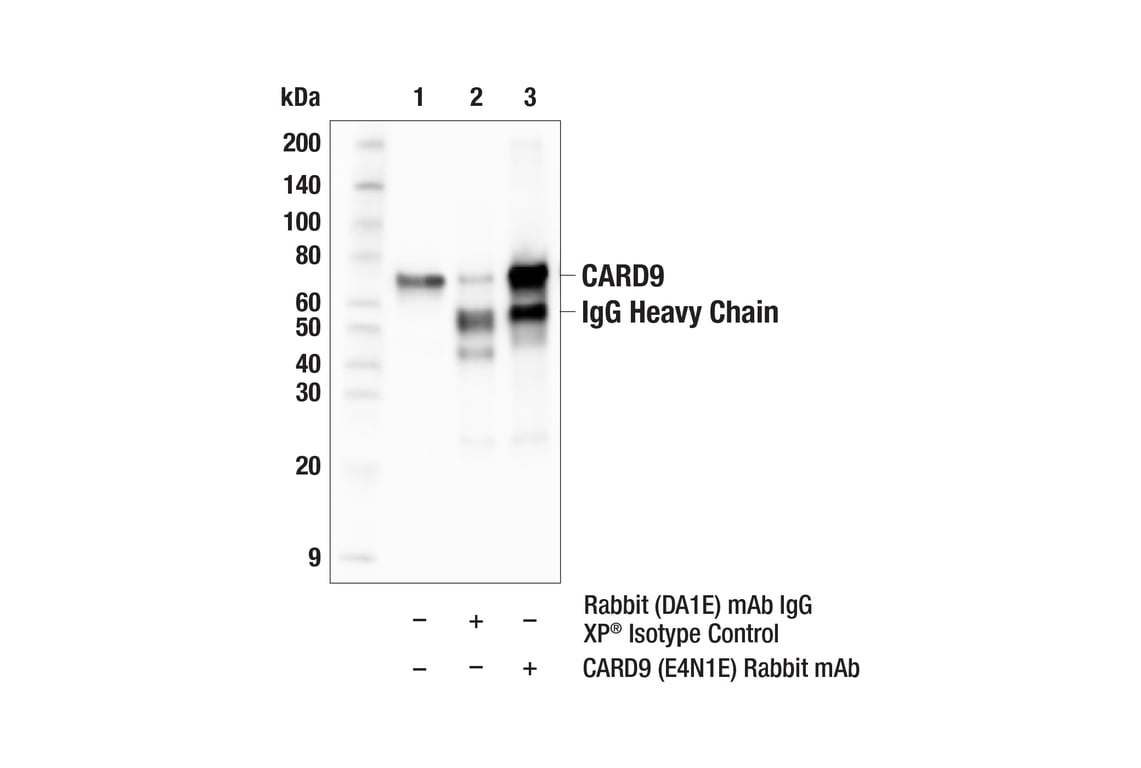 Immunoprecipitation Image 1: CARD9 (E4N1E) Rabbit Monoclonal Antibody