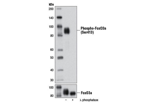 Western Blotting Image 2: Phospho-FoxO3a (Ser413) (D77C9) Rabbit Monoclonal Antibody