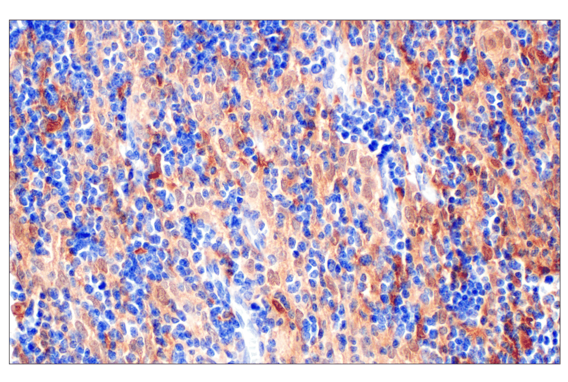 Immunohistochemistry Image 1: BLVRA (F7Z7R) Rabbit Monoclonal Antibody