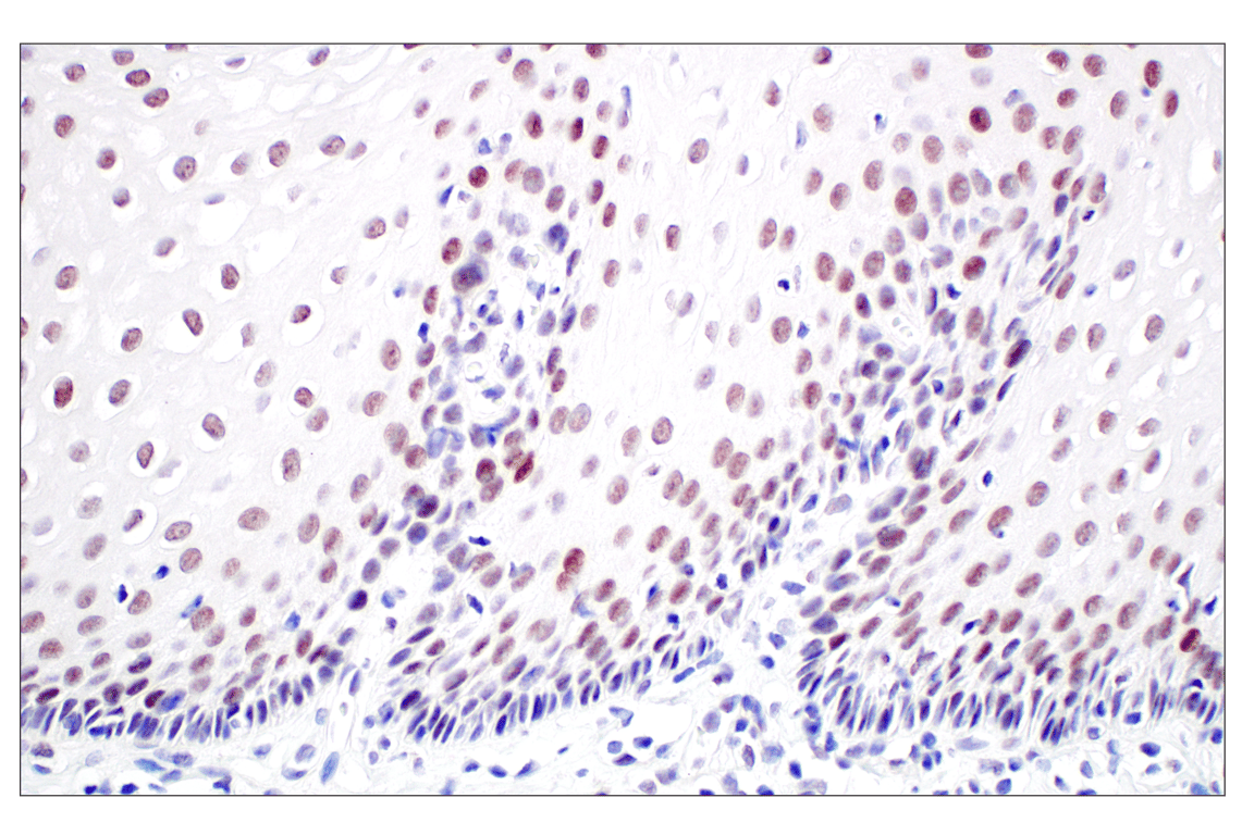 Immunohistochemistry Image 5: MDM2 (F7W7X) Rabbit Monoclonal Antibody