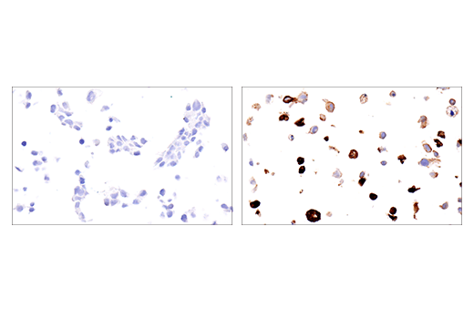 Immunohistochemistry Image 1: Ly-6G (E6Z1T) Rabbit Monoclonal Antibody