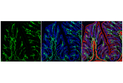 Immunofluorescence Image 1: VISTA (D5L5T) Rabbit Monoclonal Antibody (BSA and Azide Free)