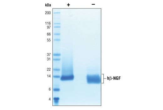 undefined Image 2: Human β-Nerve Growth Factor (hβ-NGF)