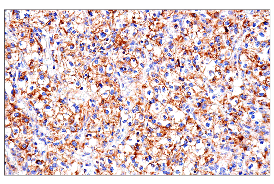 Immunohistochemistry Image 5: SLC25A1 (E7B2B) Rabbit Monoclonal Antibody