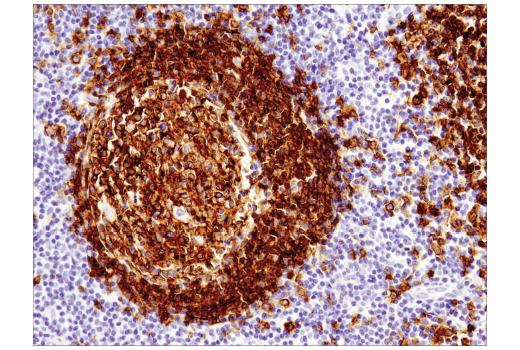 Immunohistochemistry Image 4: CD19 (Intracellular Domain) (D4V4B) Rabbit Monoclonal Antibody