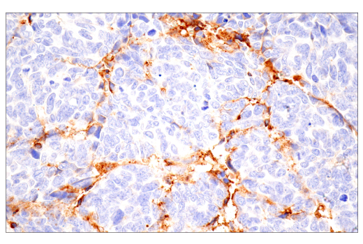 Immunohistochemistry Image 7: alpha-2-Macroglobulin (E6N7X) Rabbit Monoclonal Antibody