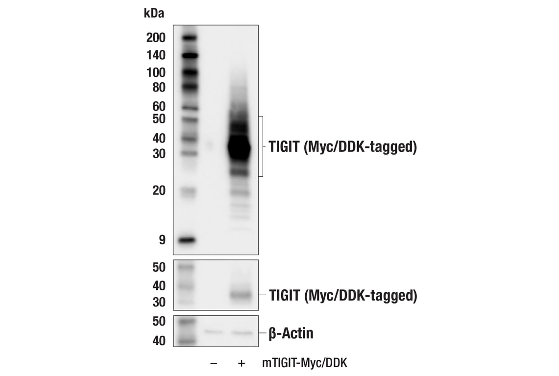 Western Blotting Image 2: TIGIT (E6Q3G) Rabbit Monoclonal Antibody
