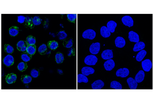 Immunofluorescence Image 1: IFNAR2 (E7Z4M) Rabbit Monoclonal Antibody