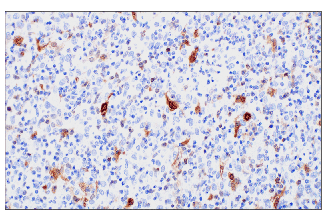 Immunohistochemistry Image 5: PBK/TOPK (F2X2Z) Rabbit Monoclonal Antibody