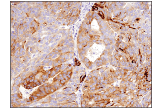 Immunohistochemistry Image 5: Synaptophysin (D8F6H) Rabbit Monoclonal Antibody