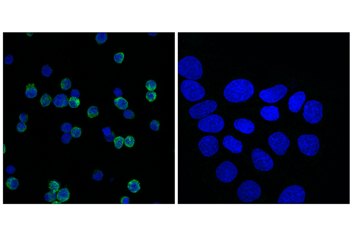 Immunofluorescence Image 1: MYH11 (E4Q4L) Rabbit Monoclonal Antibody