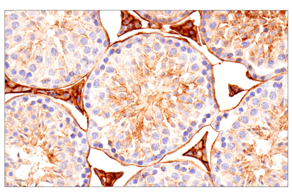 Immunohistochemistry Image 11: CD81 (D5O2Q) Rabbit Monoclonal Antibody (BSA and Azide Free)