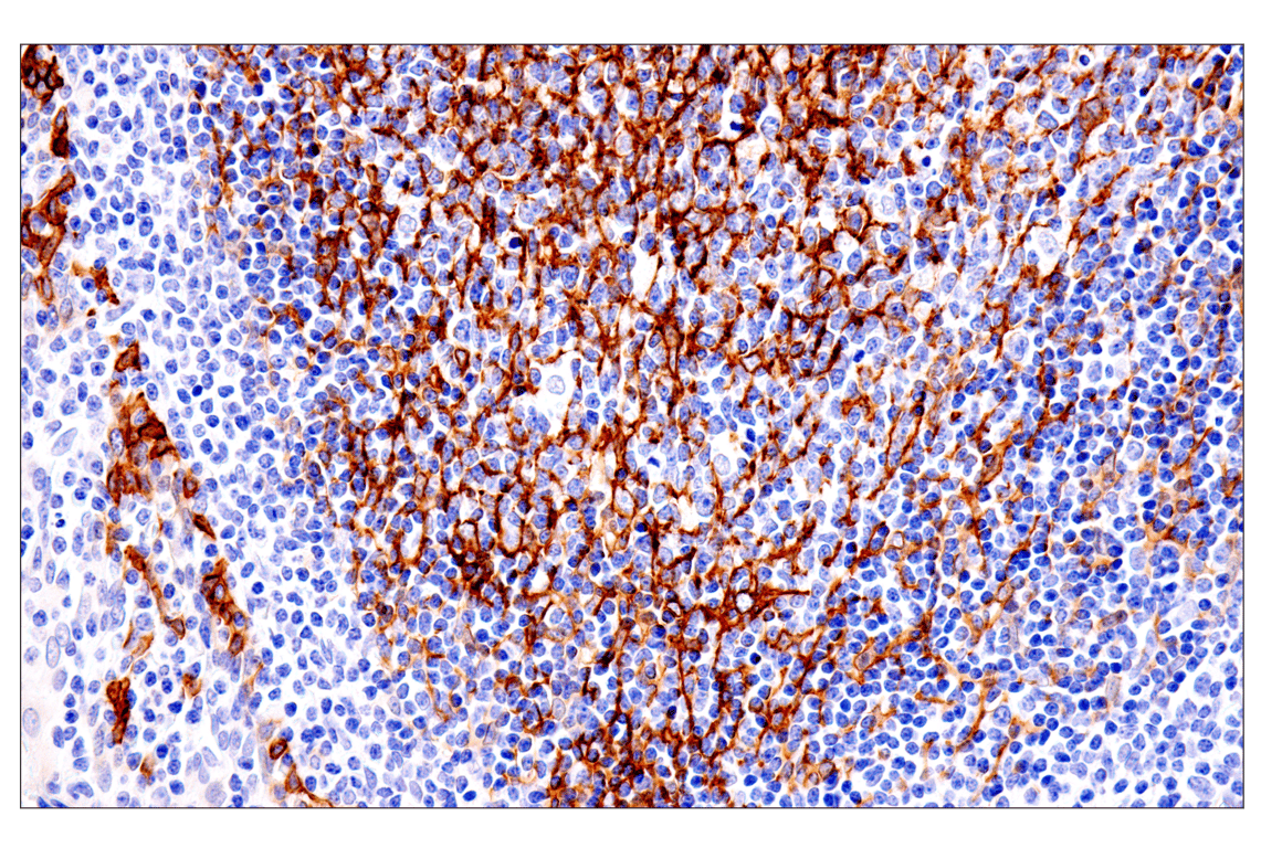 Immunohistochemistry Image 6: p75NTR (E7I3M) Rabbit Monoclonal Antibody (BSA and Azide Free)