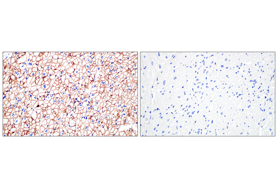 Immunohistochemistry Image 7: Dystrophin (E4F3S) Rabbit Monoclonal Antibody