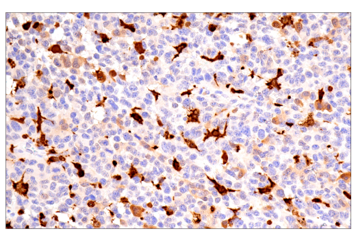 Immunohistochemistry Image 11: Galectin-3/LGALS3 (E7B6R) Rabbit Monoclonal Antibody
