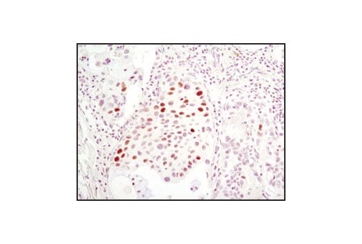 Immunohistochemistry Image 1: MCM7 (D10A11) Rabbit Monoclonal Antibody