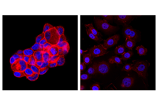 Immunofluorescence Image 1: Ras (E4K9L) Rabbit Monoclonal Antibody (Alexa Fluor<sup>®</sup> 647 Conjugate)