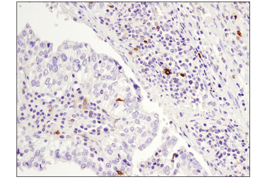 Immunohistochemistry Image 1: OX40 (E9U7O) XP<sup>®</sup> Rabbit mAb